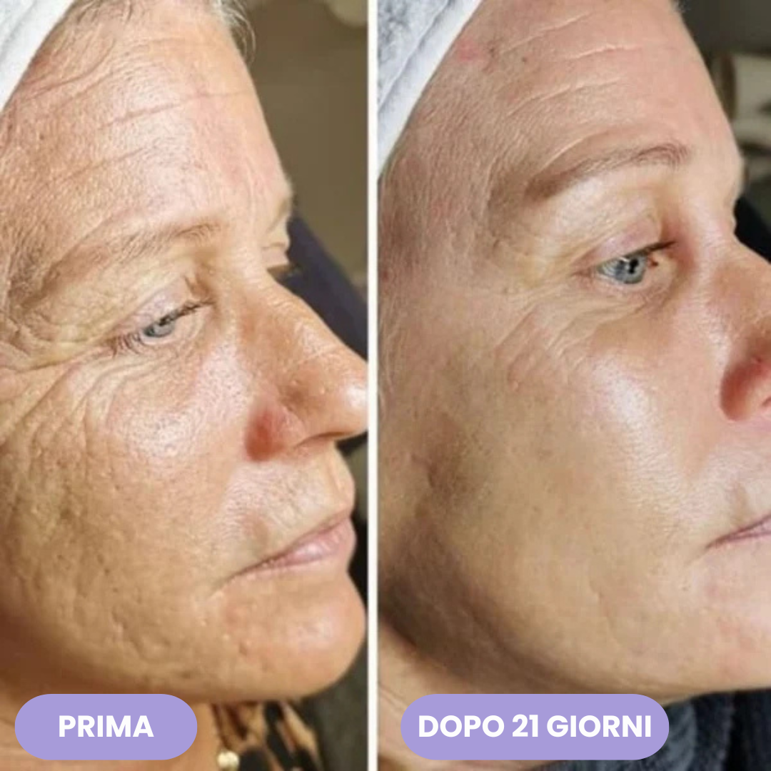 LushLift Pro™ - Massaggiatore Lifting Viso Rassodante